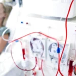 Travel Dialysis Nurse Jobs: Search Top-Paying Positions & Agencies